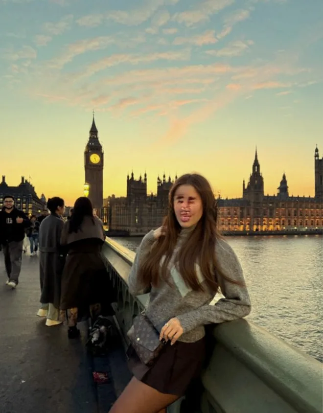 Chloe Amelie